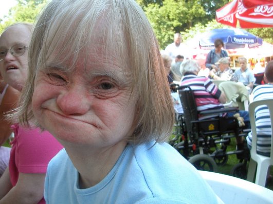 Woman with Downsyndrome