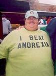 i beat anorexia